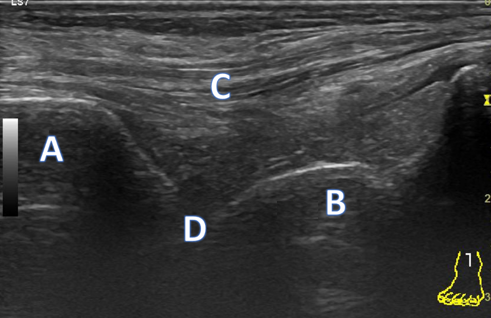 Procedure Ankle