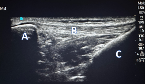 Anterior Knee