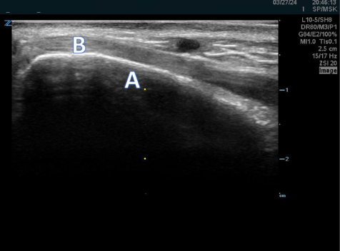 Distal Wrist