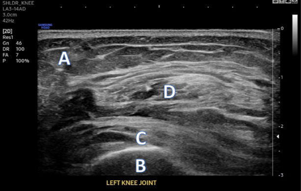 Procedure Knee