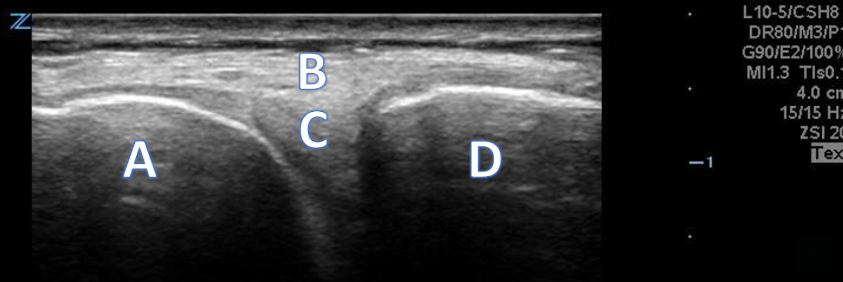 Lateral Knee
